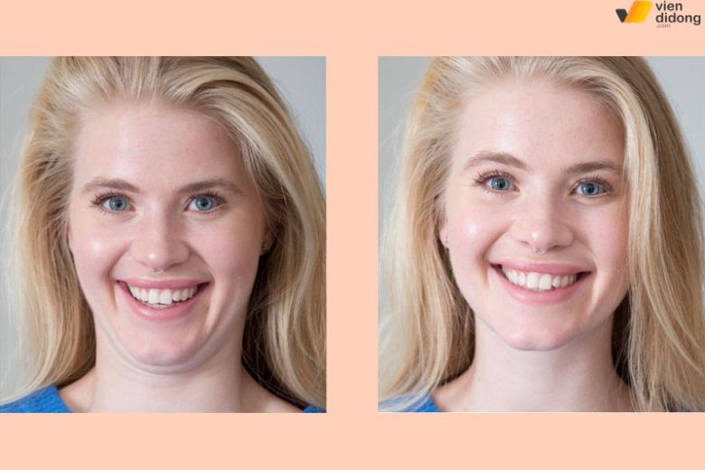 Chọn góc selfie cao giúp mặt gọn, tự nhiên